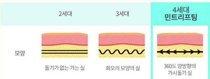 실 모양 비교 - 돌기 없는 가는 실, 회오리 모양의 실, 360도 양방향 가시돌기가 있는 민트실