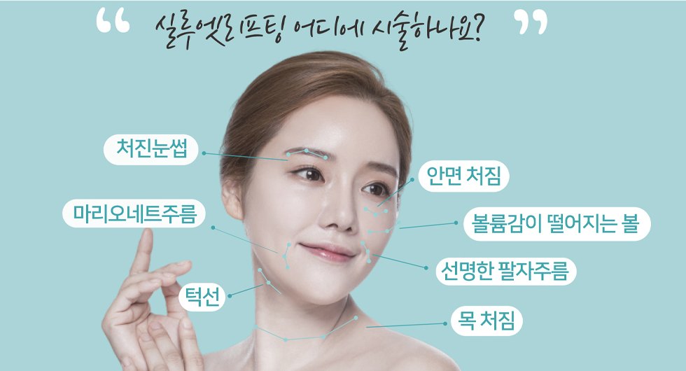 실루엣 리프팅 시술 부위 - 처진 눈썹, 안면 처짐, 볼, 팔자주름, 마리오네트 주름, 턱선, 목