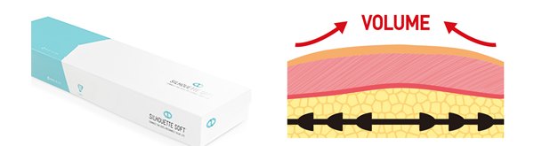 실루엣소프트 실 제품과 볼륨 리프팅 원리 그래픽